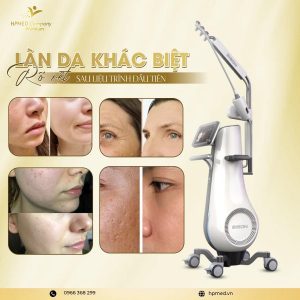 Máy RF Vi Điểm Chính Hãng - Công Nghệ Fractional Microneedle RF - HPMED